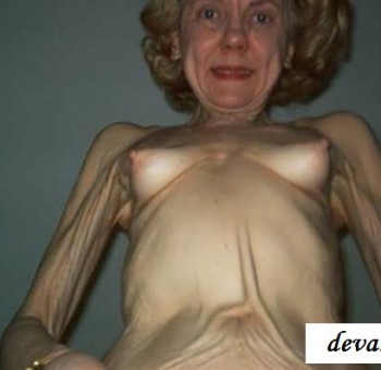 Голые старухи - Высохшие тела древних бабушек (19 фото эротики) Высохшие тела древних бабушек (19 фото эротики)