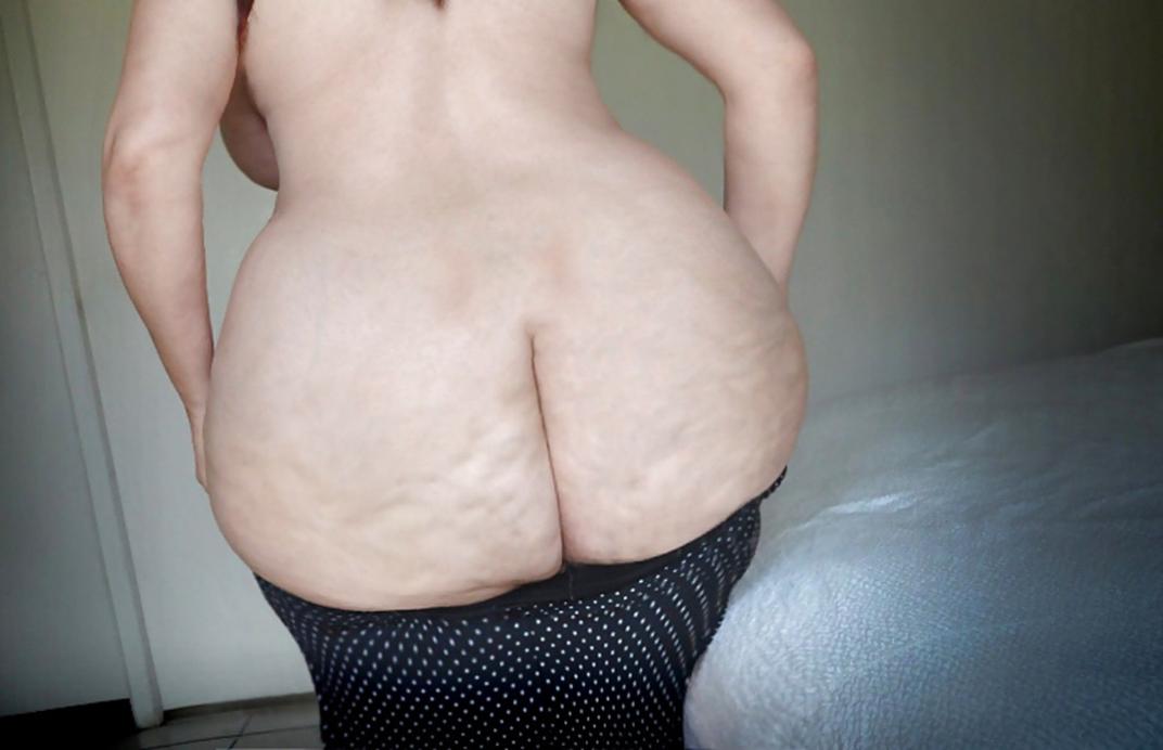 Толстые целлюлитные попы